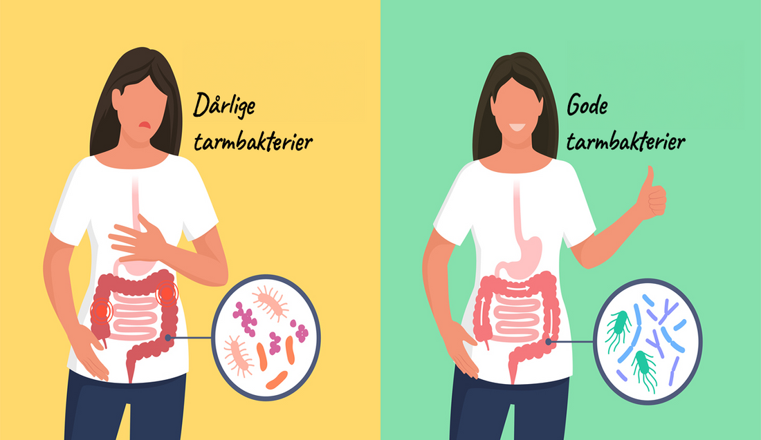 Gastrointestinala sjukdomar är den förbisedda epidemin.